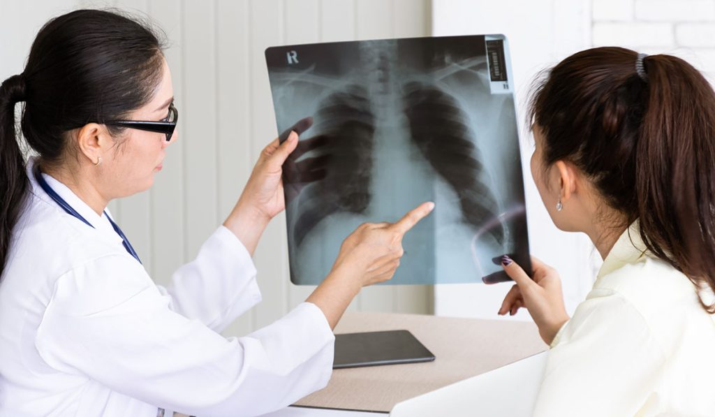 rak pluća liječenje i dodatna terapija klinički kontekst